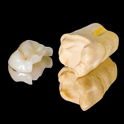 Model partial dental crown restoration